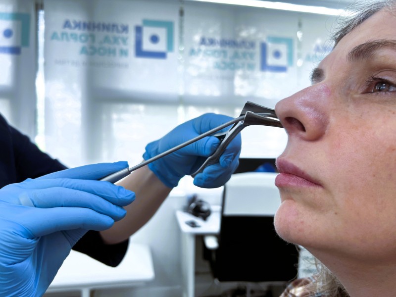 Зондирование пазух