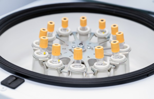 Прицельная диагностика здоровья в Сочи! Расширенное лабораторное обследование со скидкой до 50%