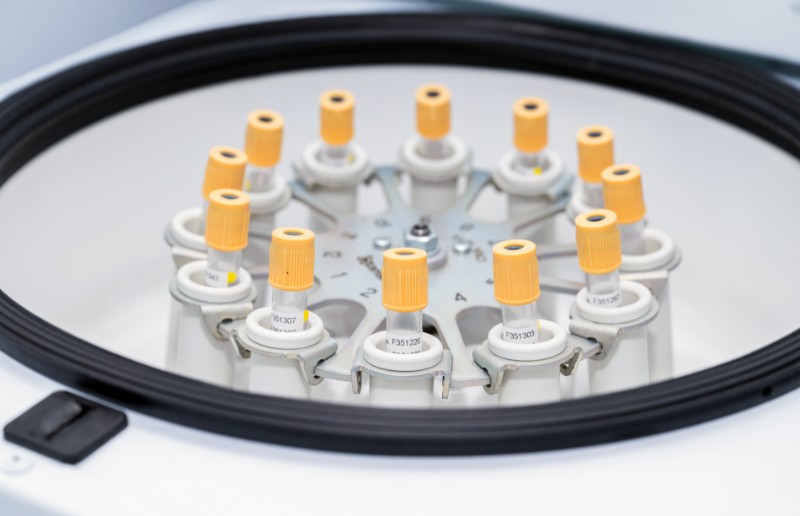 Прицельная диагностика здоровья в Сочи! Расширенное лабораторное обследование со скидкой до 50%