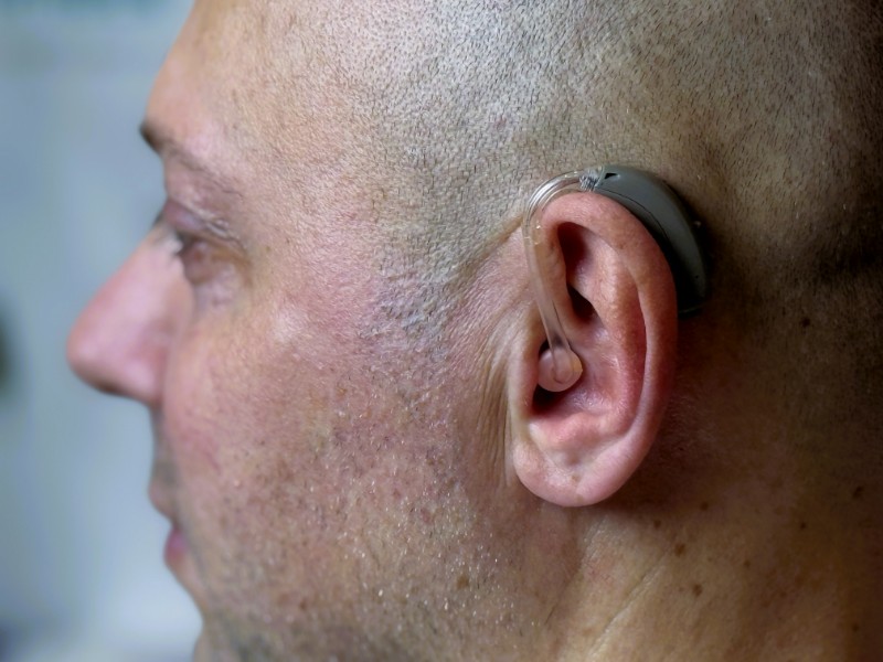 Слухопротезирование