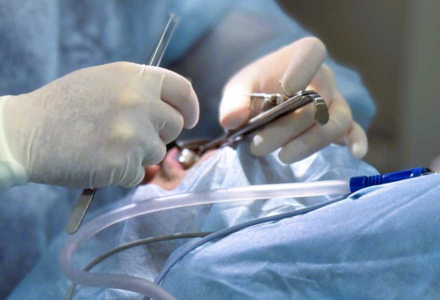 Септопластика носовой перегородки