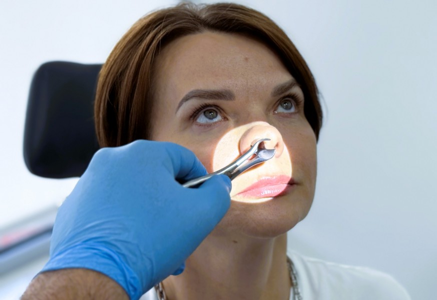 Лечение аллергического ринита