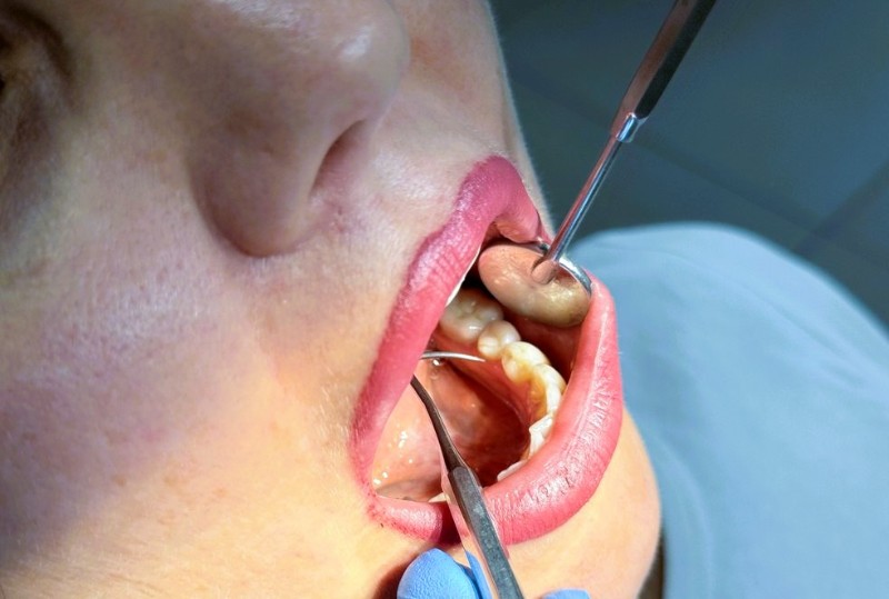 «Клиника уха, горла и носа» объявляет о стратегическом партнерстве с ведущими стоматологиями